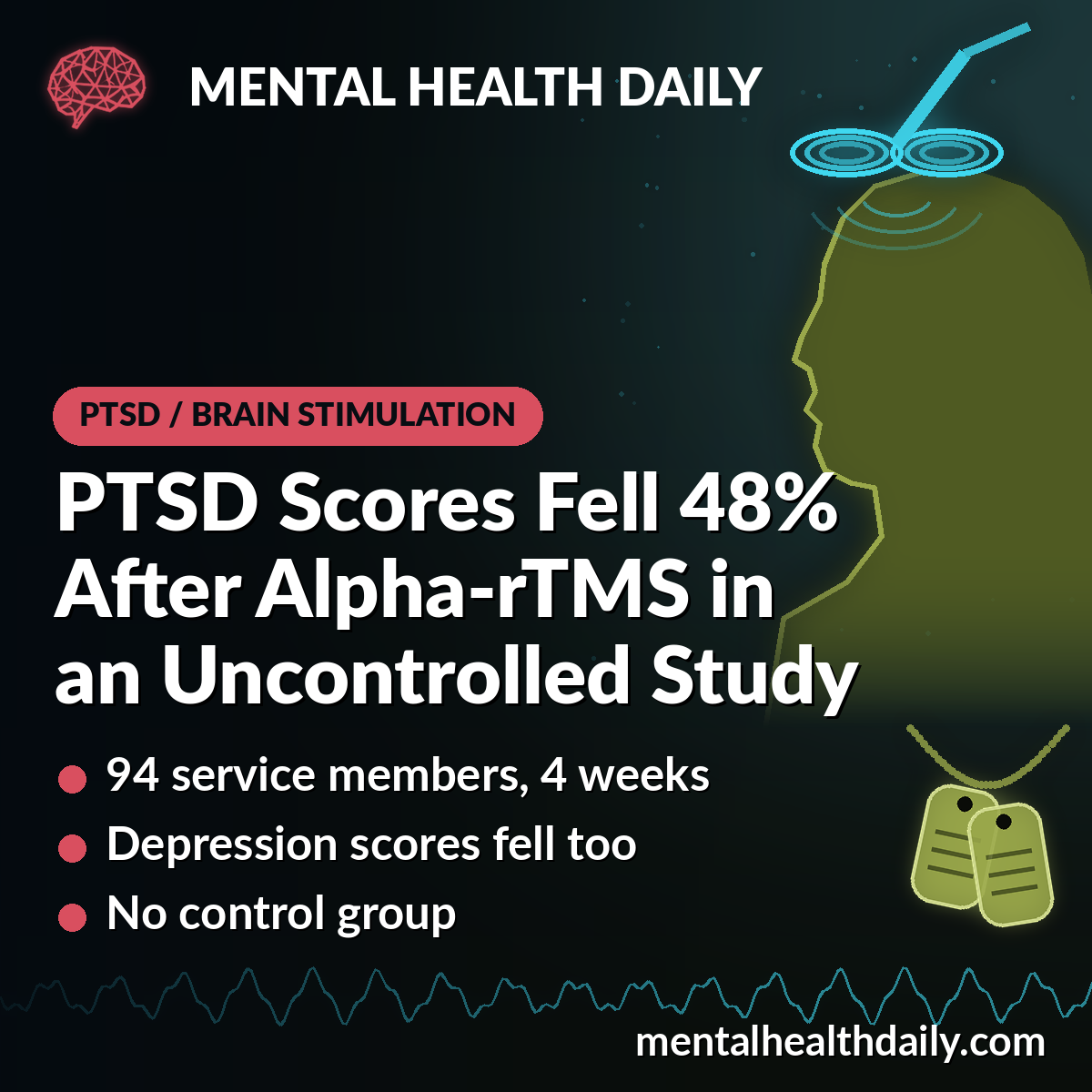 PTSD Symptoms Fell 48% After Alpha-rTMS in Uncontrolled Military Study