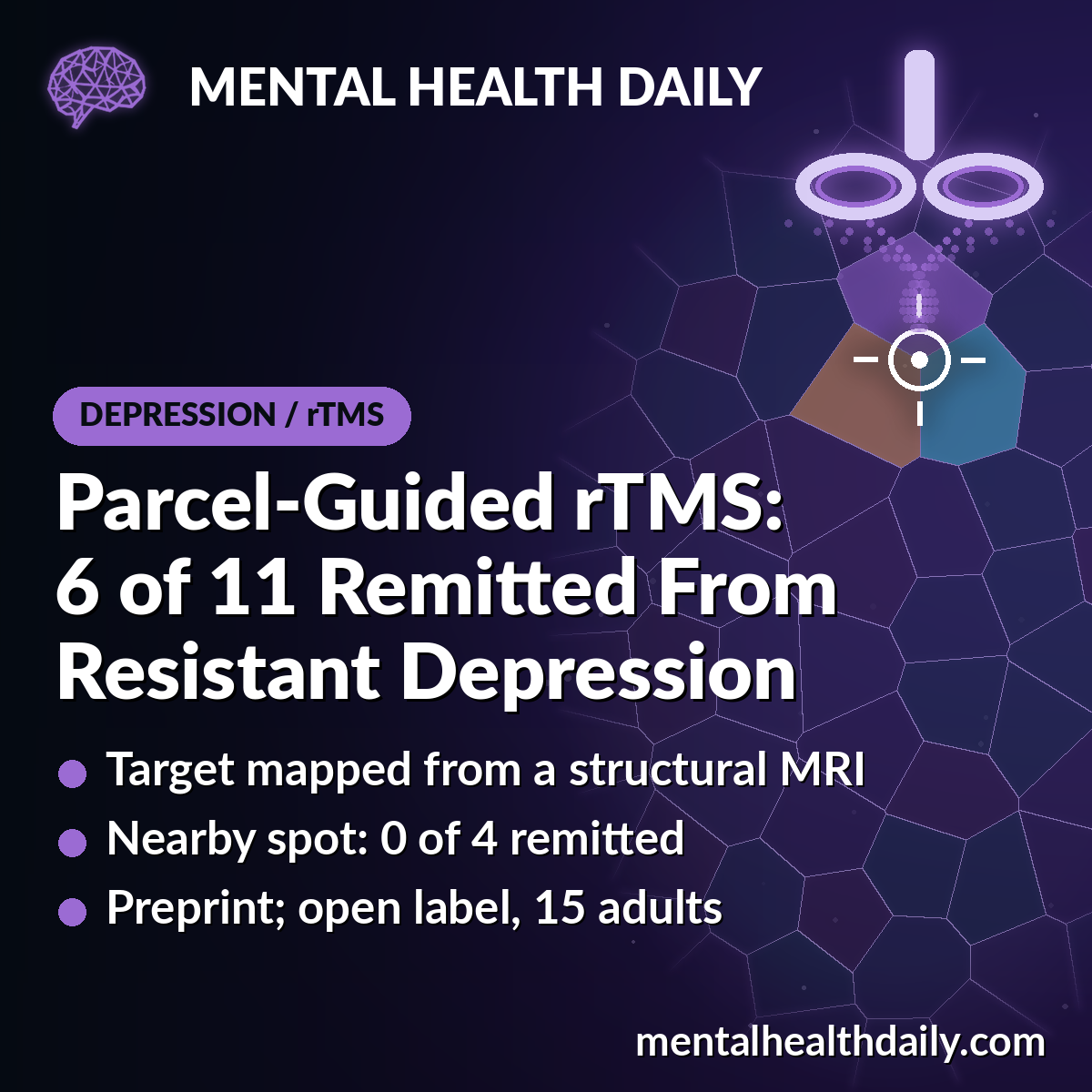 Parcel-Guided rTMS for Treatment-Resistant Depression: 6 of 11 Remitted in Pilot