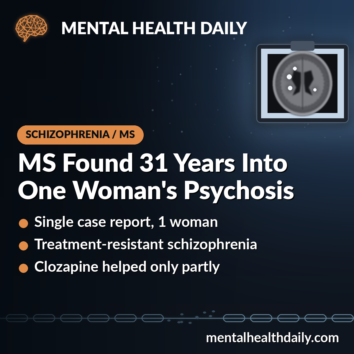 Multiple Sclerosis Found in 1 Patient With Treatment-Resistant Schizophrenia